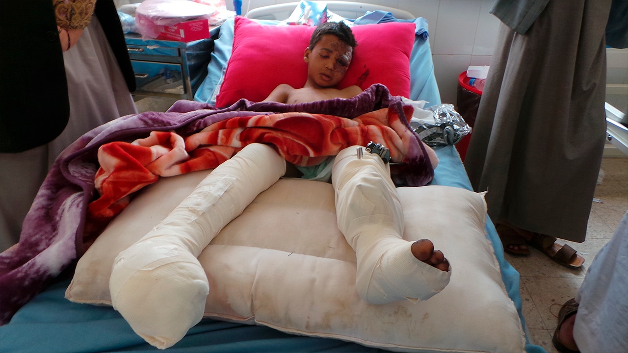 Photo of child in hospital after Yemen airstrike attack