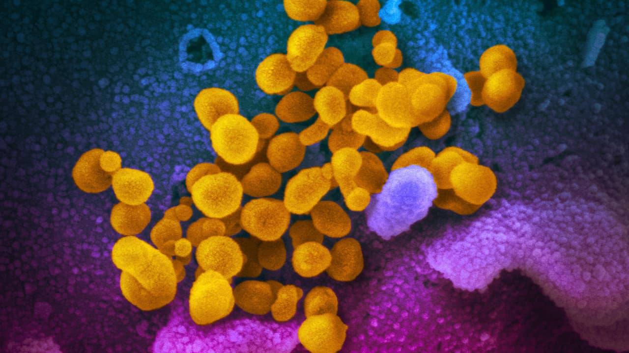 Photo of the Novel Coronavirus SARS-CoV-2, yellow, emerging from the surface of cells, blue/pink