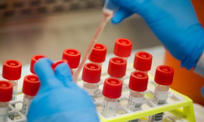 Photo of coronavirus patient samples