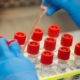 Photo of coronavirus patient samples